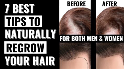 hair thickness measurement|7 natural ways to regrow your hair.